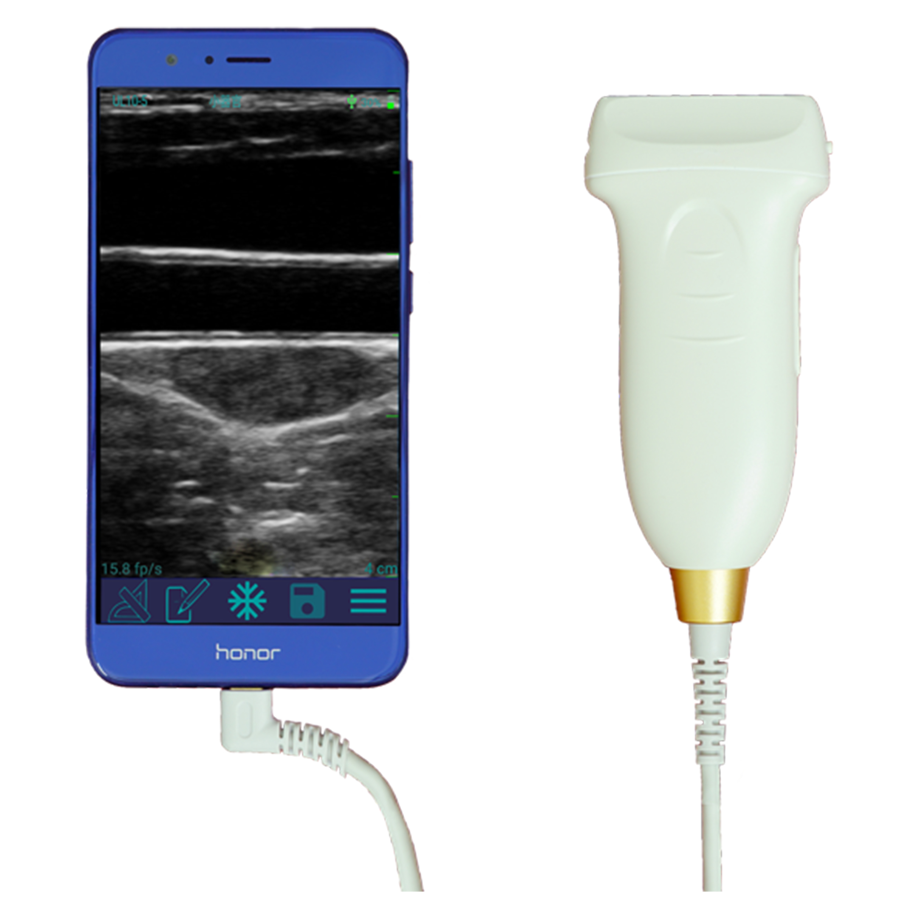 Amain MagiQ 128 Elements Handheld Diagnostic ultrasound system Instrument Buy USB ultrasound scanner