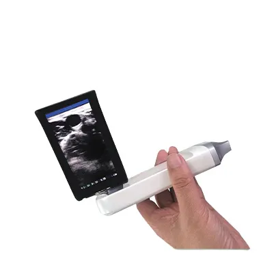 Amain Ultrasound Handheld Device MagiQ LW5X with Good Quality for Primary Health Examination ultrasound machine for hospital