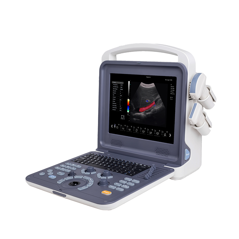 AMAIN ស្វែងរក C2 Factory Price Laptop Transducer Ultrasound