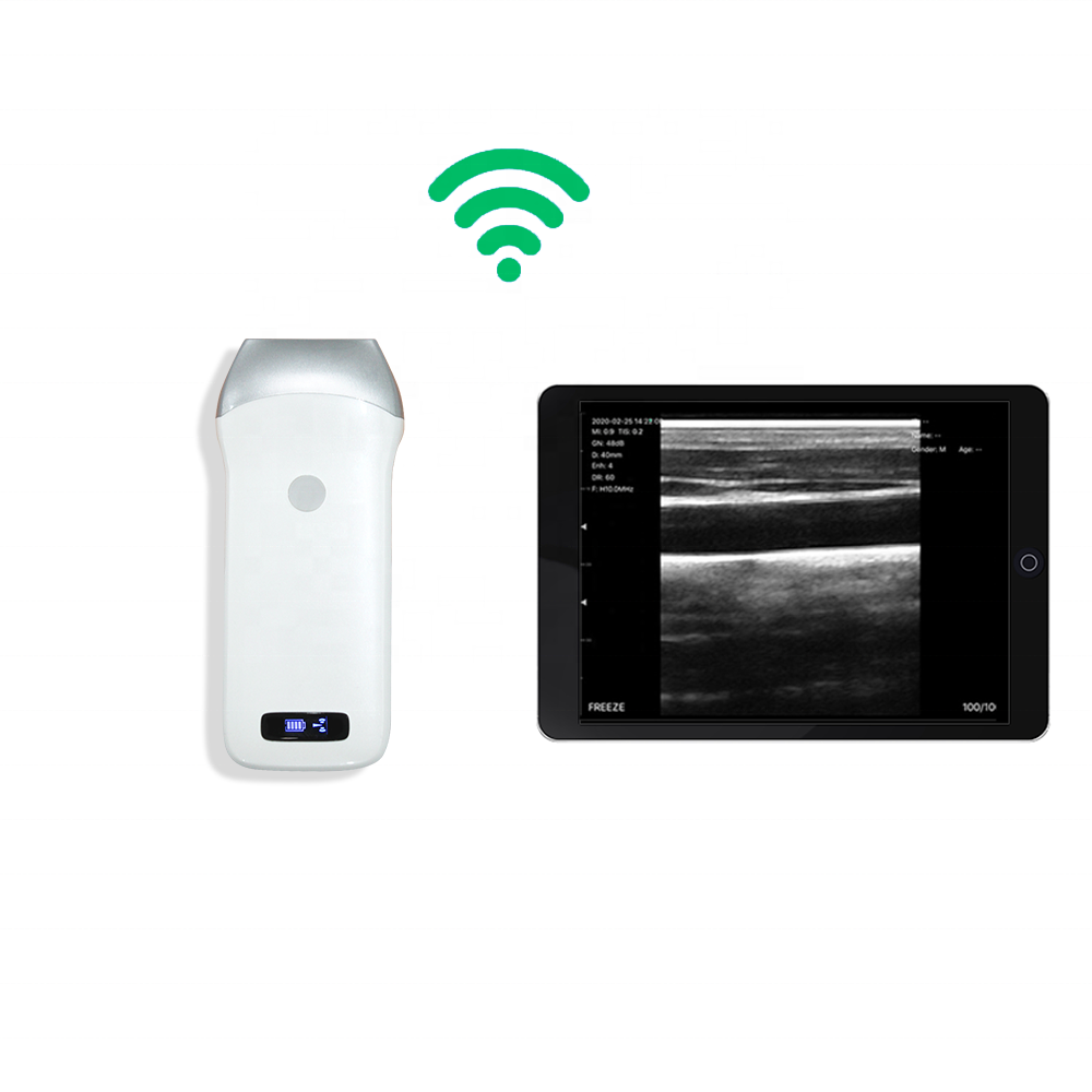 Amain MagiQ LW3 Linear BW Wireless Pocket Medical Ultrasound Machine miaraka amin'ny rafitra Android sy IOS