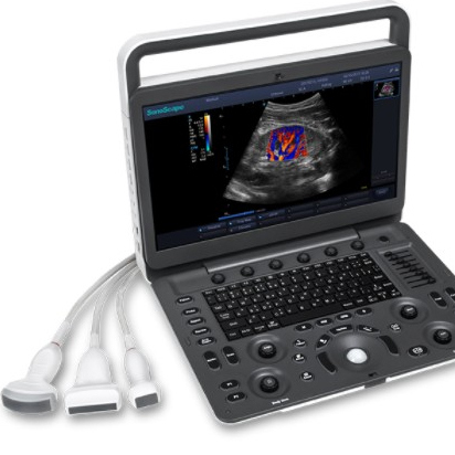 Sonoscape E3  tablet portable ultrasound system China Supplier Professional  Color Doppler Ultrasound Diagnostic Instrument