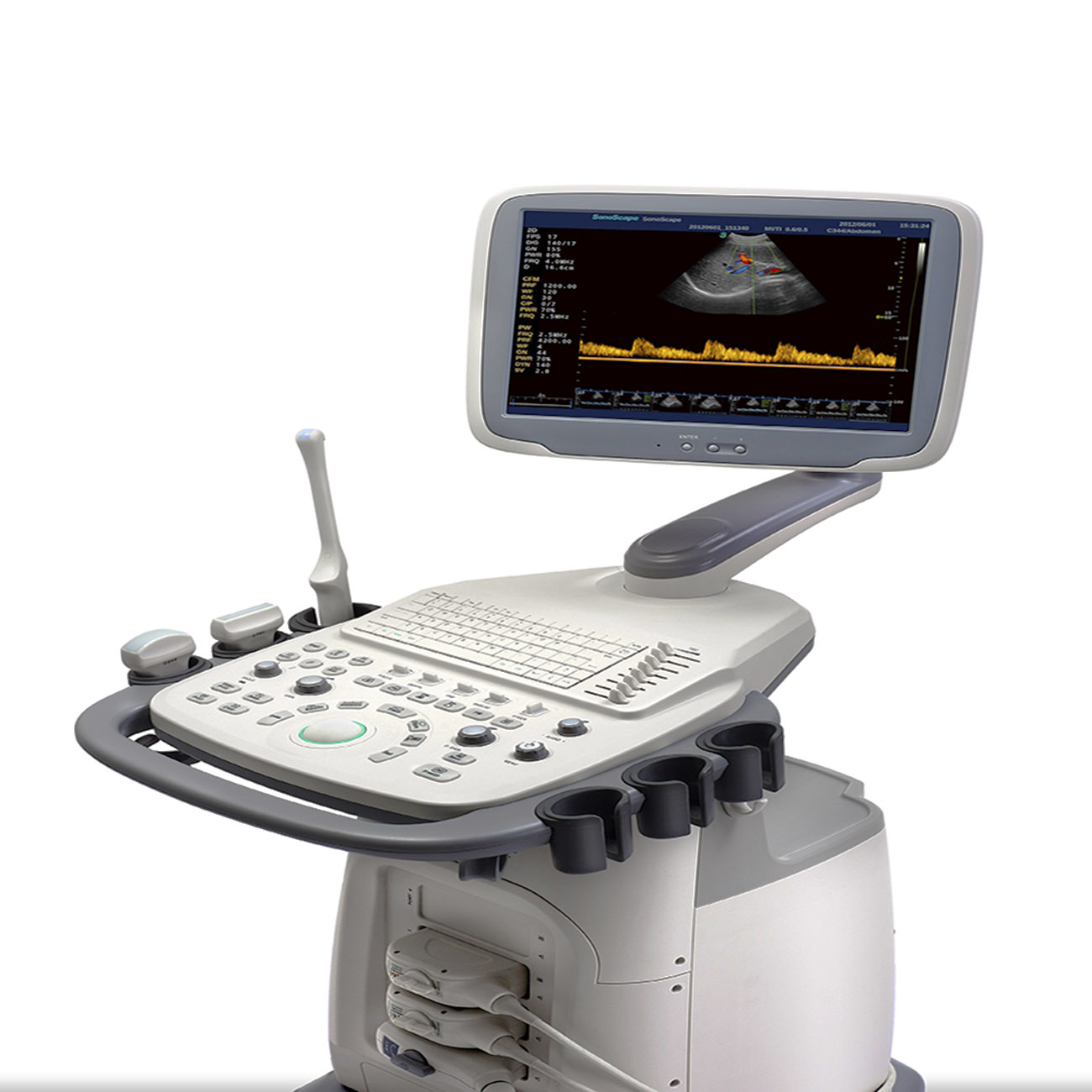 Sonoscape S11 2D 3D 4D color doppler ultrasound cart system for specialized OB/GYN clinical detection