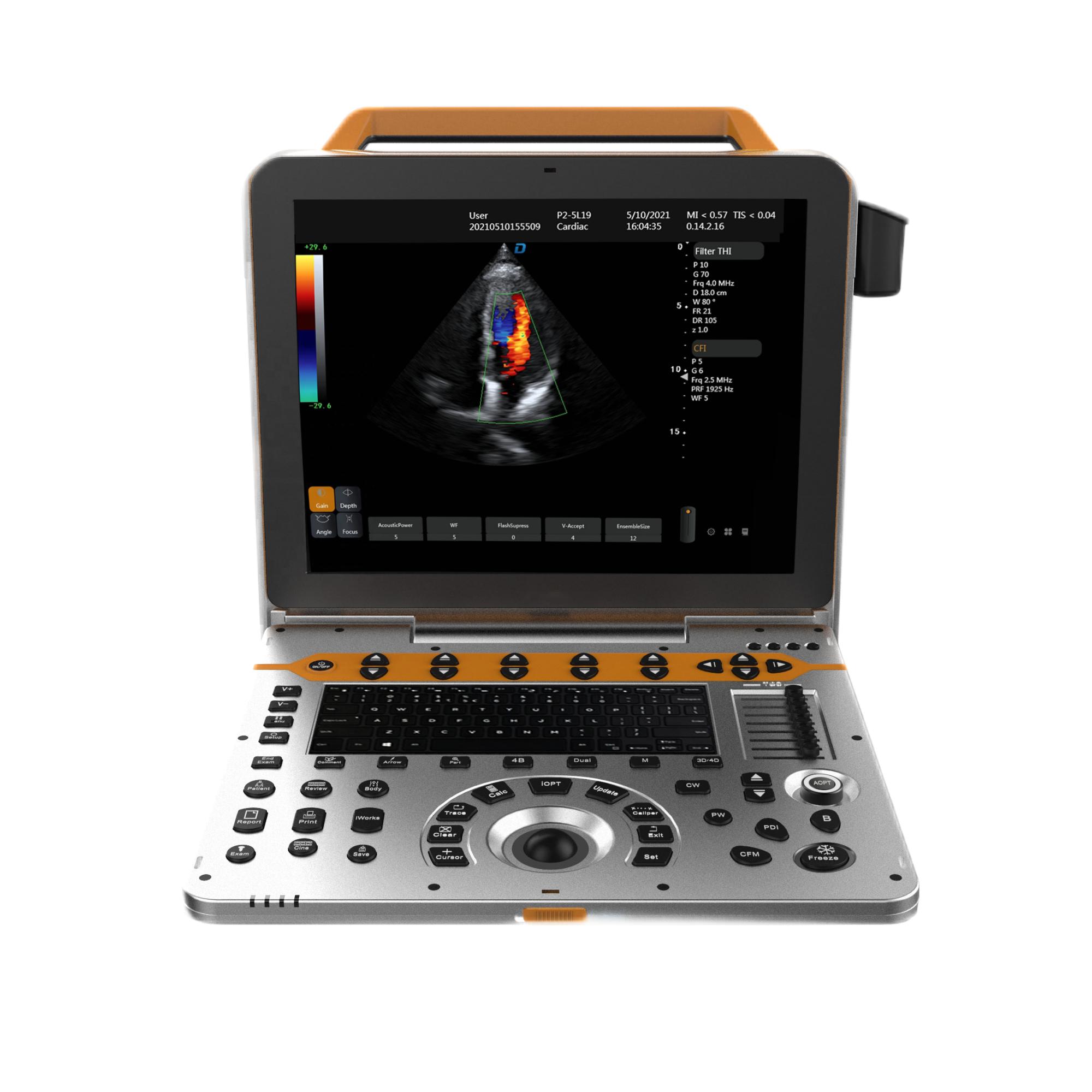 Amain  AMDV-P8LITE  3D/4D Full Digital portable Color Doppler medical ultrasound instruments with Full Digital Ultrasound System