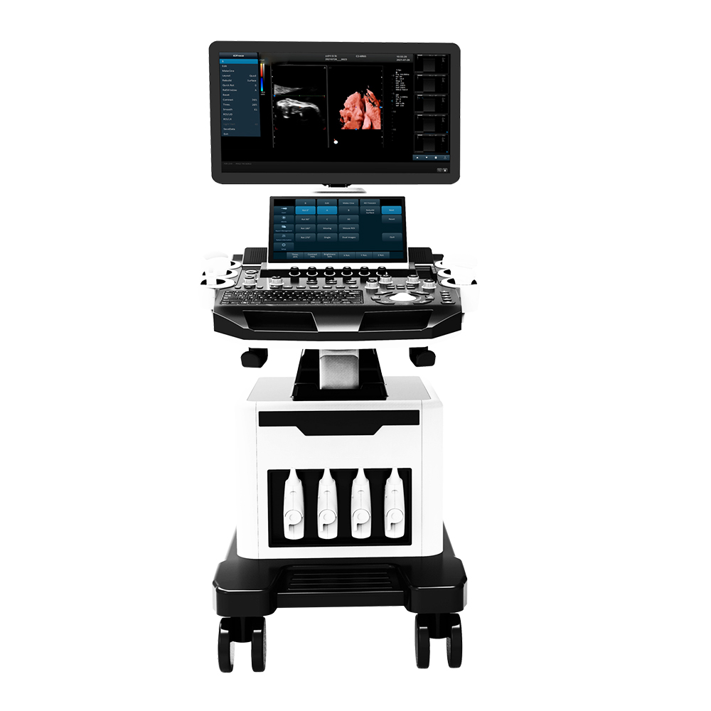 Amain Dual-screen AMDV-T5 Pro trolley 4D/5D color doppler ultrasonic Diagnostic Apparatus with a high-resolution medical display