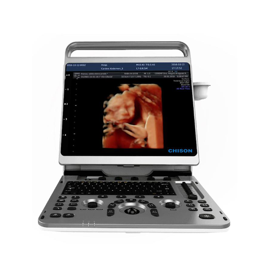 Chison ebit 30/ ebit 60 3D/4D/5D 고주파 노트북 도플러 초음파 기계 Sonoscape E1/E2/E3 Mindray 초음파와 동일