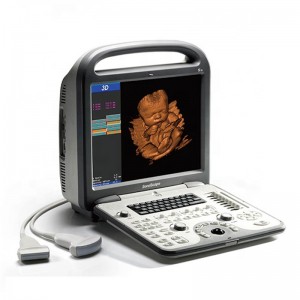 SonoScape S6 Cardiac ۽ Transvaginal Laptop الٽراسائونڊ