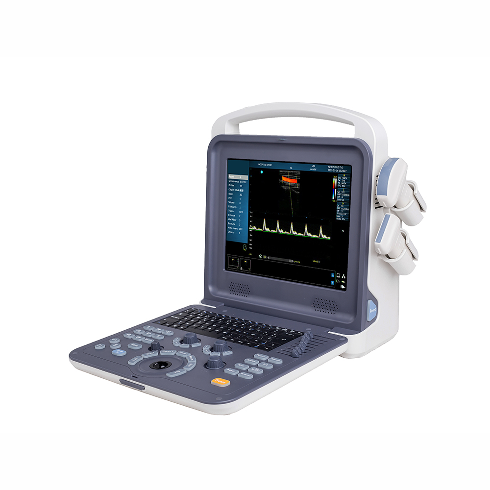 AMAIN Atrodiet C0 planšetdatora B režīma ultraskaņas iekārtu