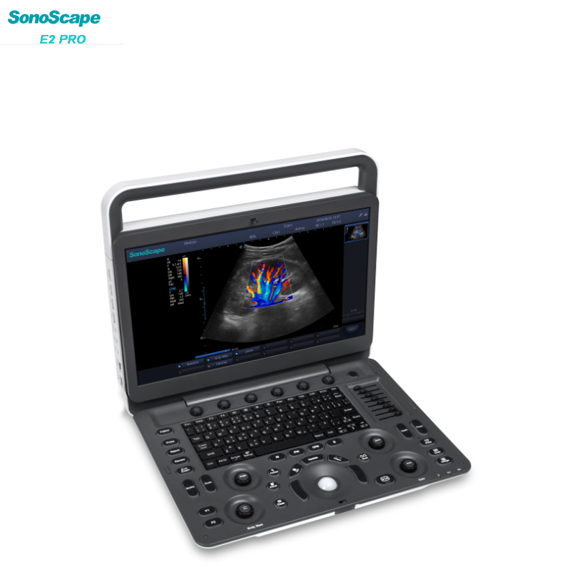 Fast delivery 3d 4d Ultrasound Machine - 2023 Sonoscape E2/E2 pro Portable Color Doppler System 3D 4D 5D Ultrasound Machine for MSK OB/GYN  and cardiac ultrasound – Amain