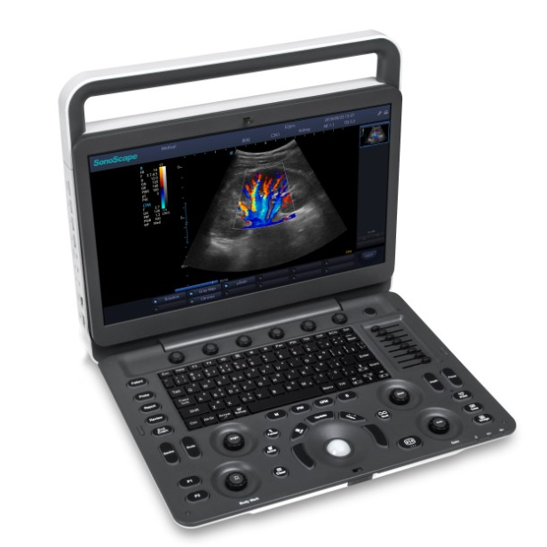 Medical Science Sonoscape E2 Pro Renkli Doppler Ultrasound'un fabrika fiyatı Ekran Yakınlaştırmalı Sonoscape E2'den daha uygun maliyetli