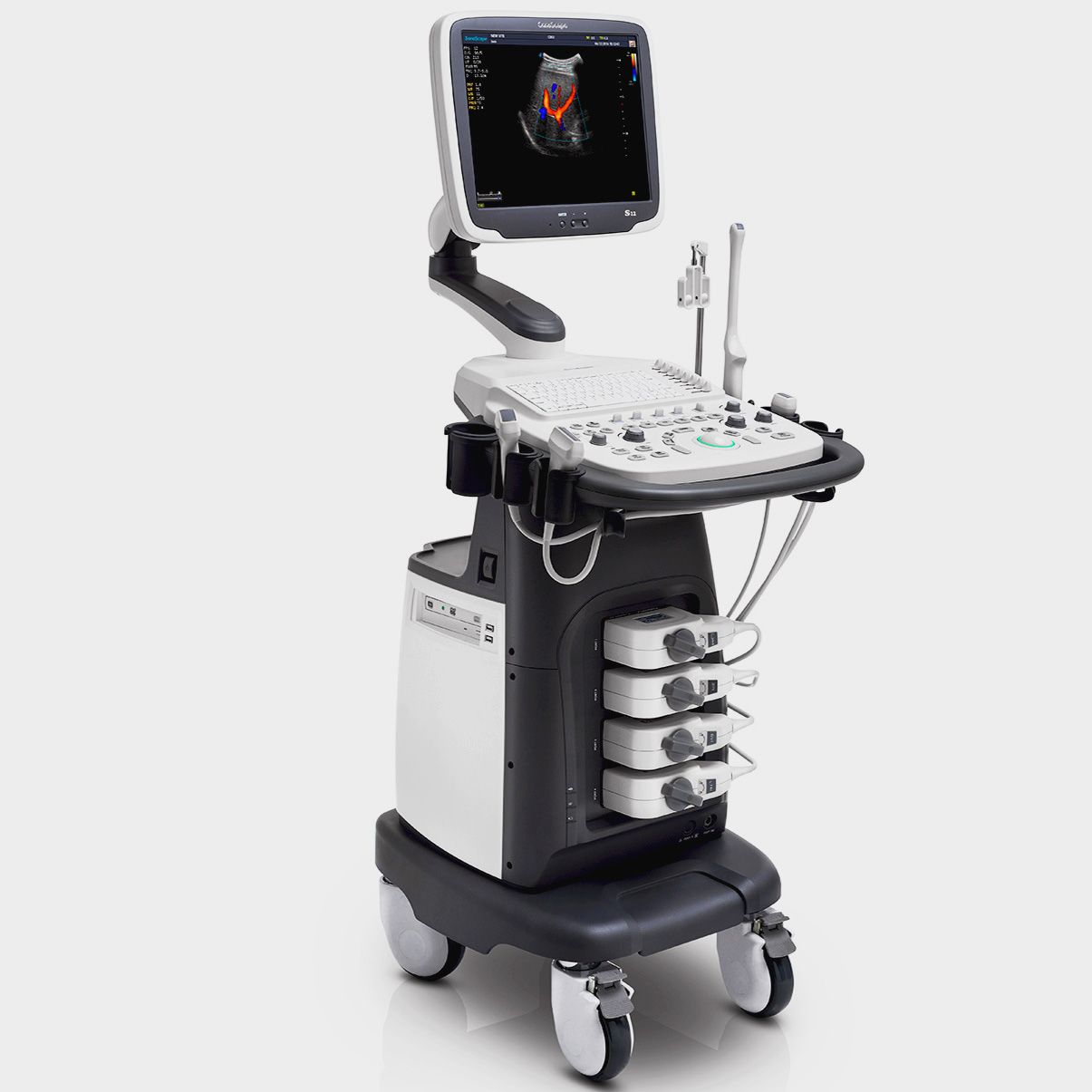 OB ve GYN Ölçümü için Sonoscape S12 4D taşınabilir ultrason arabası makinesinin en iyi fiyatı fiziksel teşhis