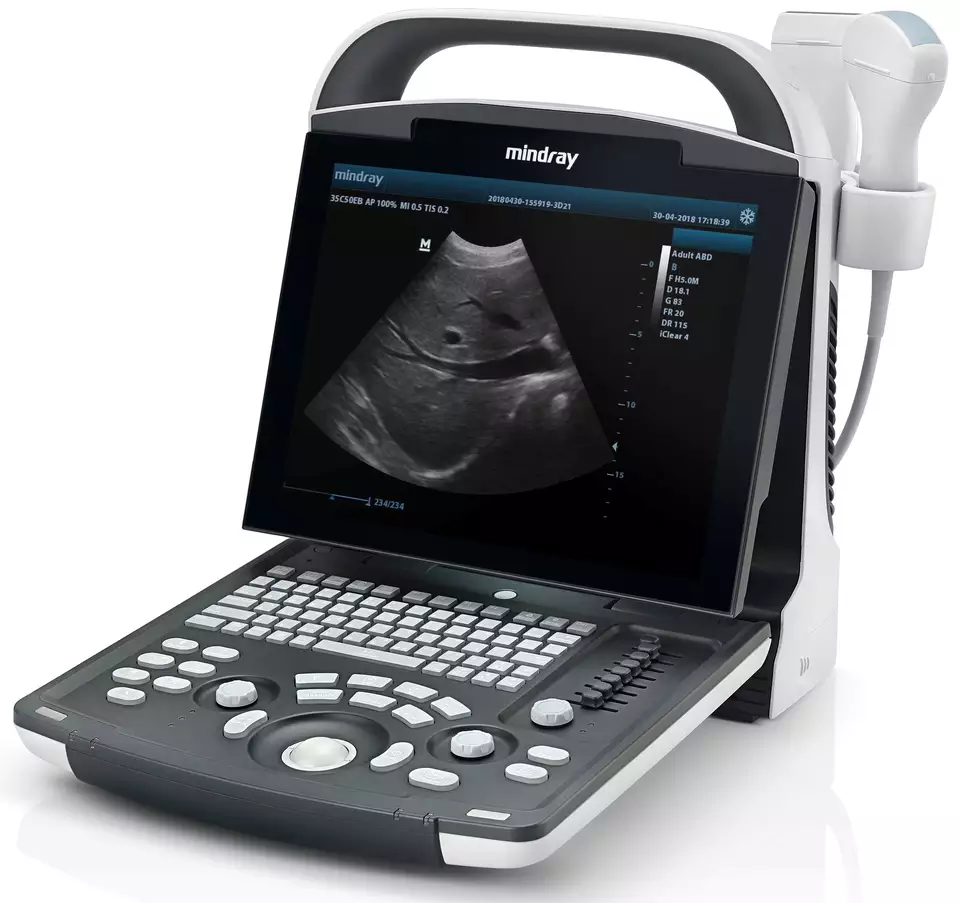 Mindray DP-10 Portable Full Digital Medical Ultrasound Instruments Ultrasound Scanner Clinical Application Ultrasound Machine