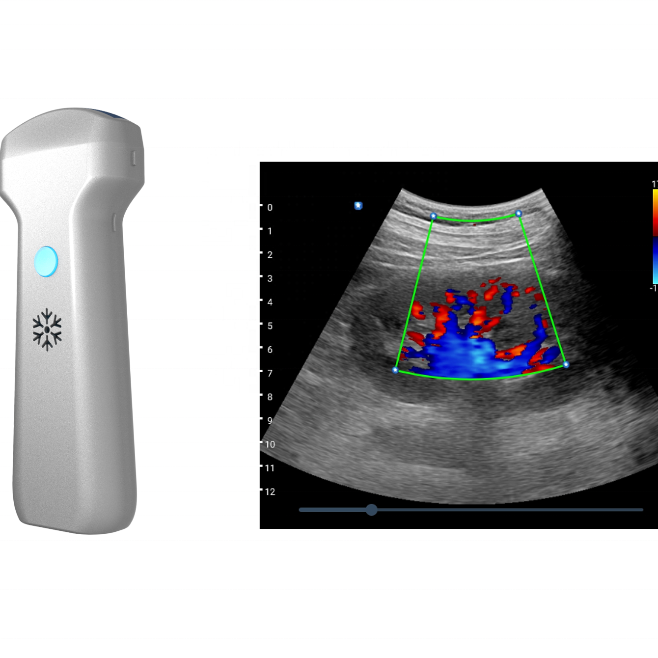 Amain OEM/ODM 2022 Najnoviji HC 32 kanala Ultra-jasna kvaliteta slike Medicinski uređaj Bežični prijenosni ultrazvučni skener Prodaja