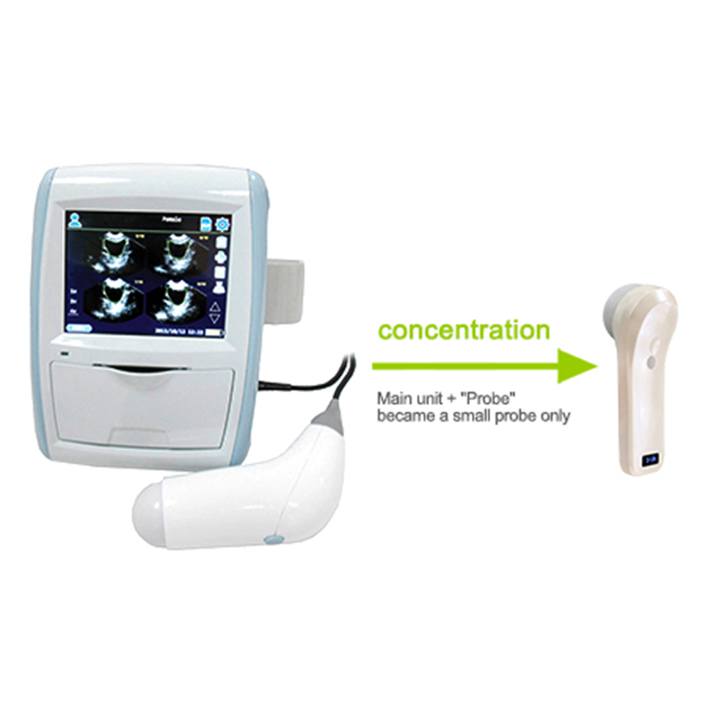 Cheap price Trolley Ultrasound Machine - Amain MagiQ-4D  waterproof Wireless Bladder Scanner for Cardiology Gastroenterology Urology and Kidney ultrasonography diagnosis – Amain