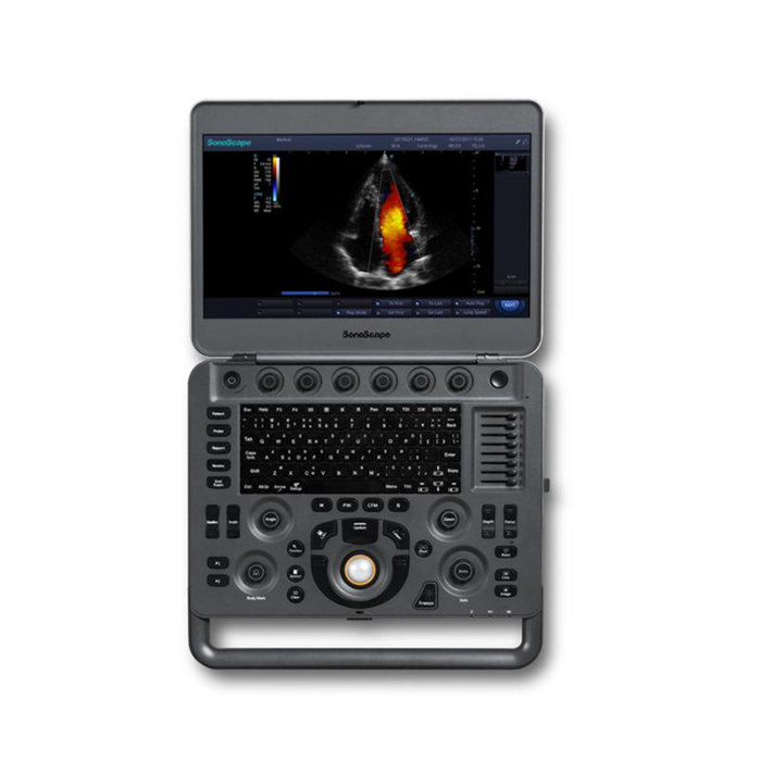SonoScape X3 180 Titling Angle Ultrasound Equipment