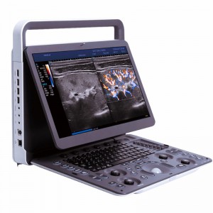 Sonoscape E2 Ultrasound machine with 15.6 inch LED Monitor