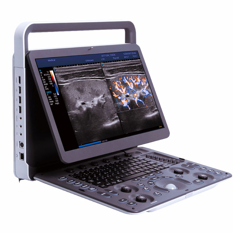 2021 Newst  Sonoscape E2 China Color Doppler Medical Portable Tablet Ultrasound system machine With 15.6 inch LED HD Monitor