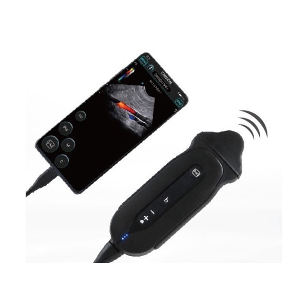 Ultrasound Chison SonoEye P6 Portable Cardiac Micro-Convex Probe สำหรับการสแกนอัลตราซาวนด์ในการใช้ยาทางคลินิก