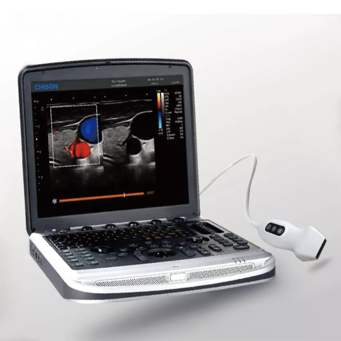 Chison sonobook 9 Cardiac Obstetrics and Gynecology 4D/5D Scanning Machine Portable Ultrasound Sale Heart Head