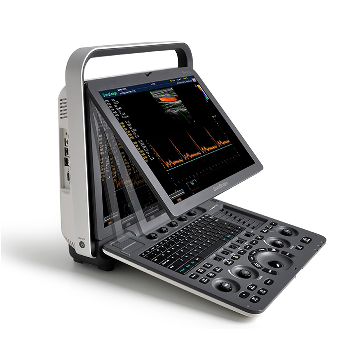 Siterite Medical Instruments SonoScape S8 Exp Ultrasound Therapy Machine For Vascular Diagnostics