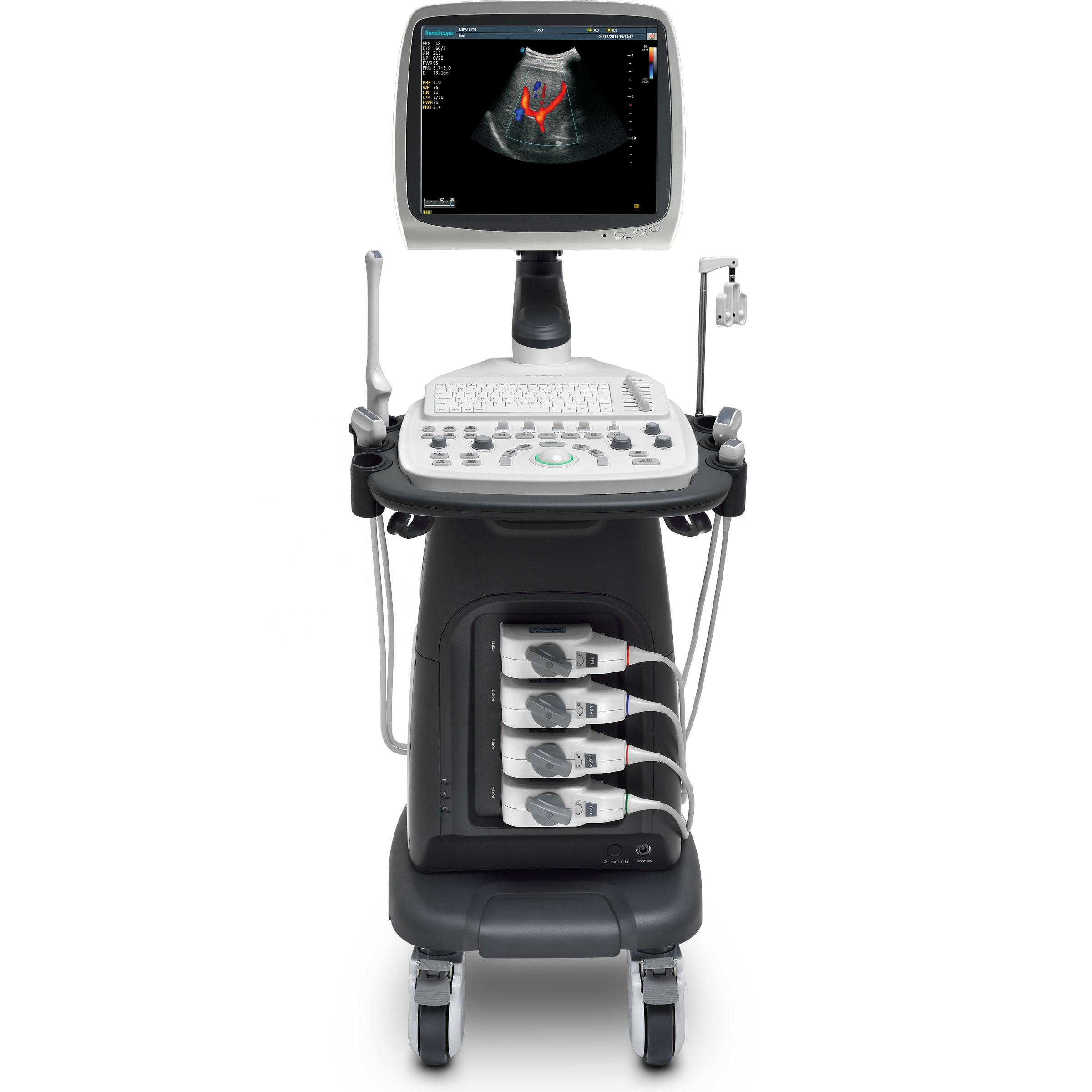 En iyi fiyat 4D Sonoscape S12 OB ve GYN Ölçümü için taşınabilir ultrason arabası makinesi fiziksel teşhis