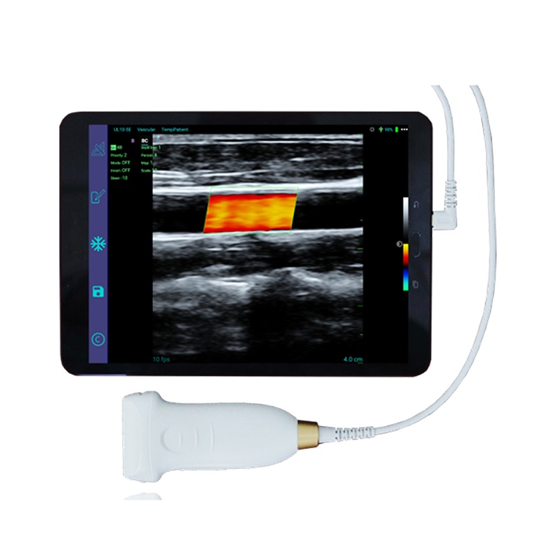 Amain Medikal malzemeleri MagiQ MCUL10-5E el tipi Renkli Doppler ve CE Sertifikası lineer problu ultrason