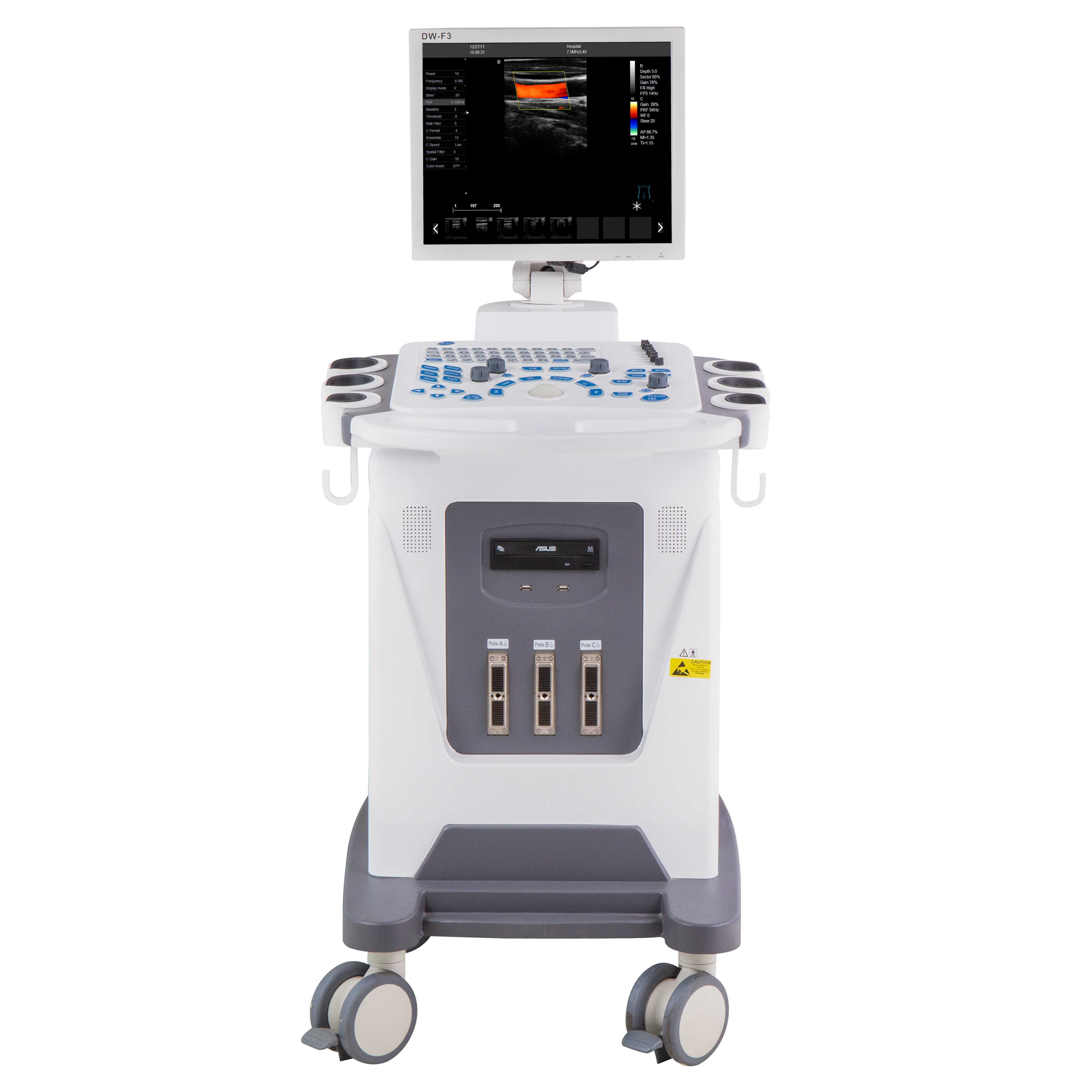 Amain Best price OEM/ODM AMDV-F3 trolley abdominal doppler ultrasound & color doppler ultrasound with 17 inch LED Monitor