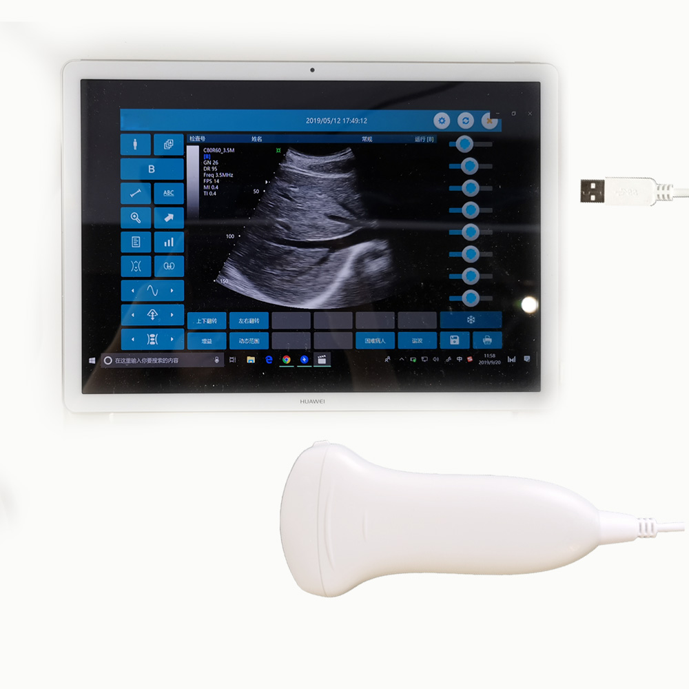 Sonda ultrasònica mèdica de butxaca d'urologia Amain MagiQ 2C