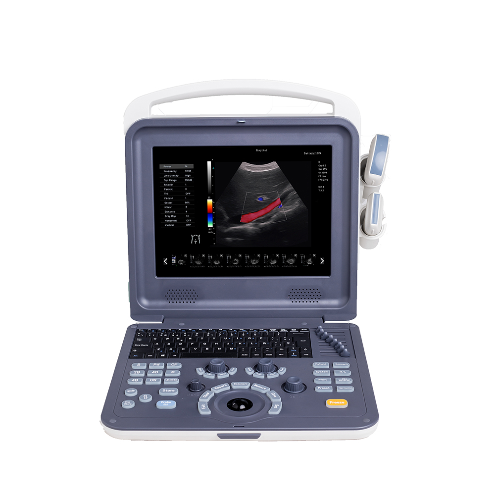 AMAIN Teangan C2 Laptop Doppler Vascular Ultrasound Mesin