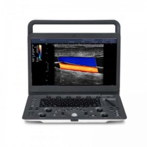 SonoScape E1 Exp Ultraschall mit einstellbarem Monitorwinkel