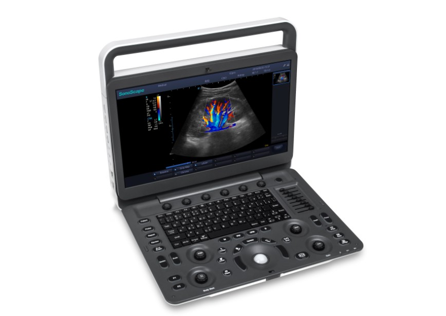 Sonoscape E2 Mobile Ultrasound for medical supplies