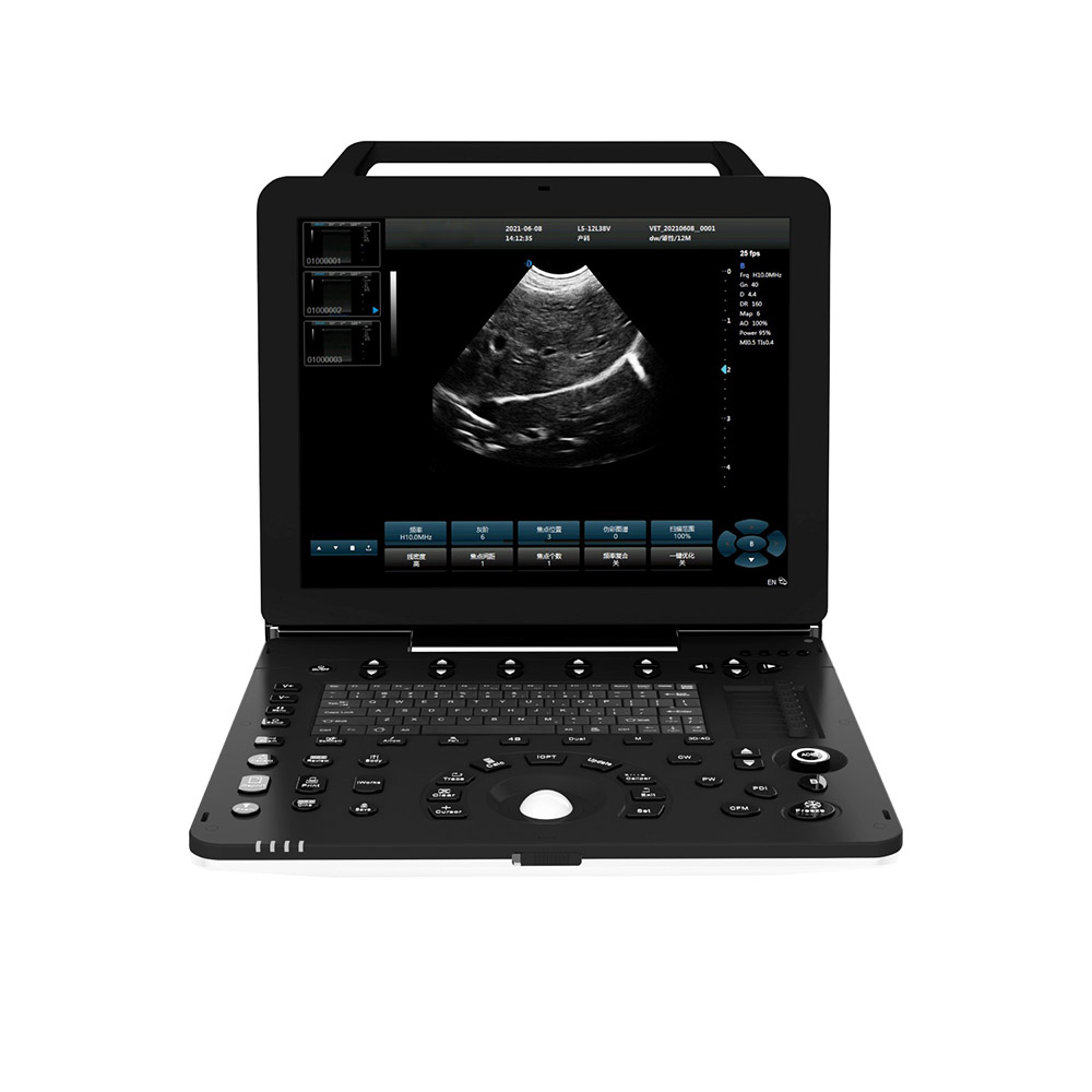 Amain OEM AMDV-P8 3D/4D  portable High-end Portable Cardiac Ultrasound laptop with Full Digital color doppler Ultrasound System