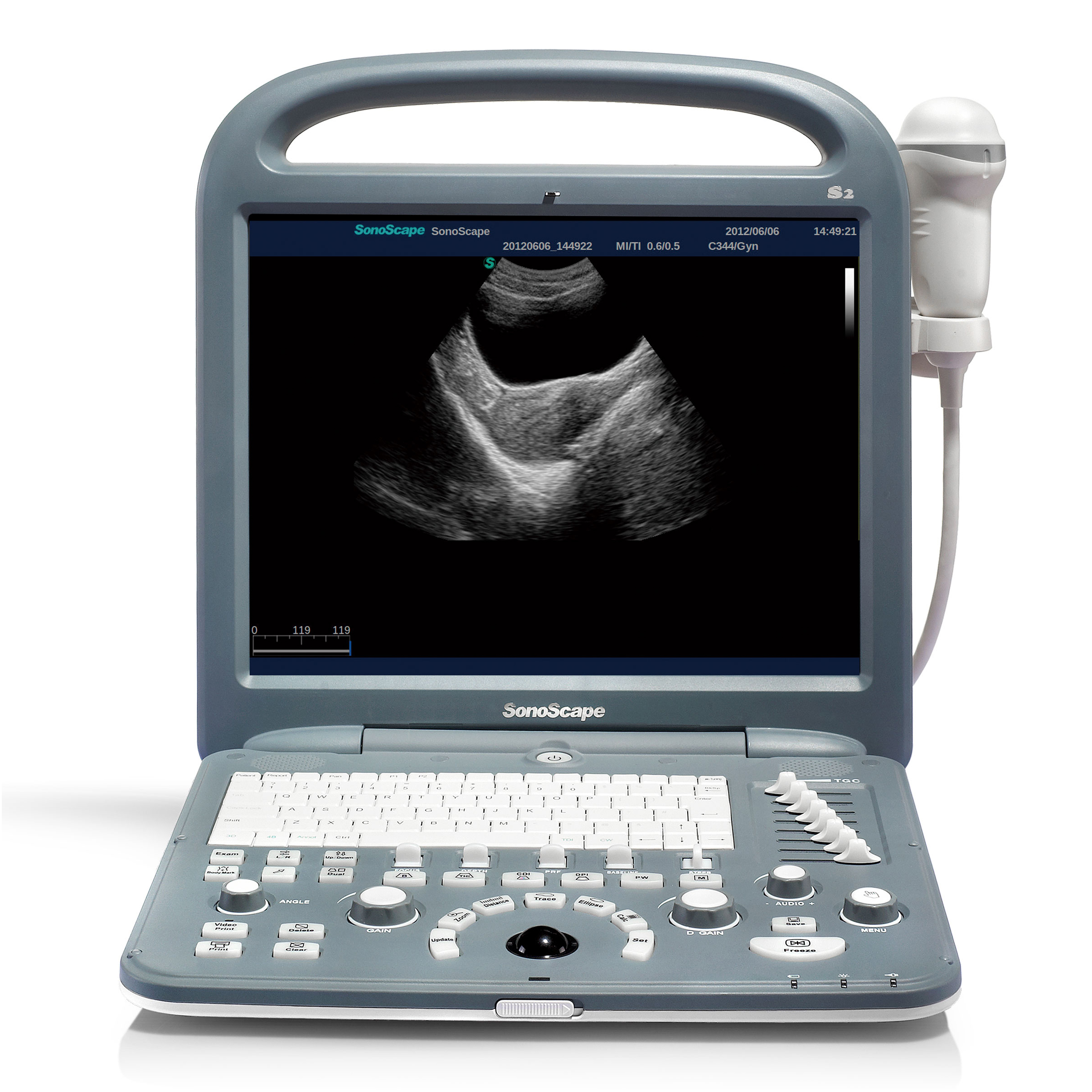 SonoScape S2 Yüksek Çözünürlüklü Hastane Kardiyoloji ve Acil Kullanım İçin Taşınabilir Dizüstü Ultrason Cihazı Kullanın
