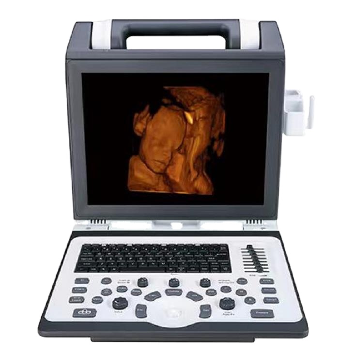 Apogee 2100 Ultrasound Laptop Portable Ultrasound Scanner with a preferred entry-level Color Doppler System