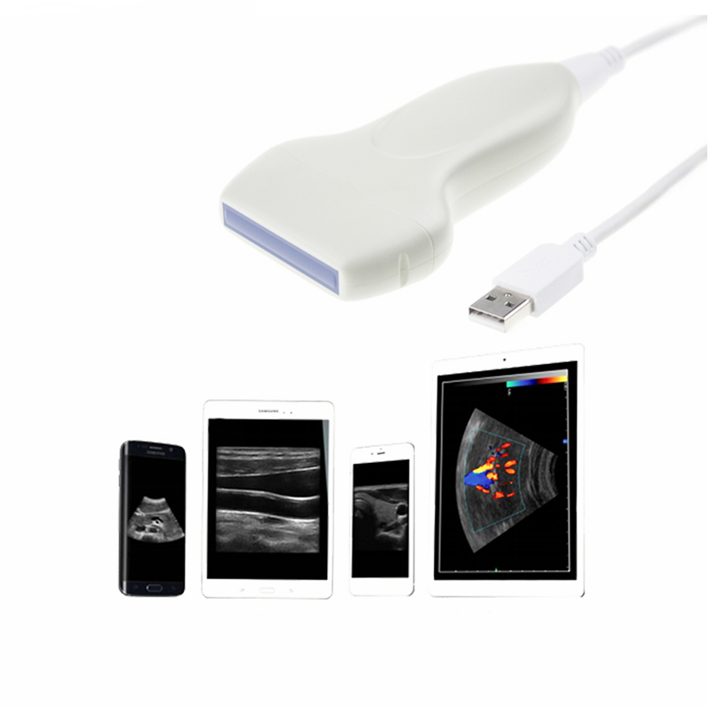 Amain MagiQ 2L lite Site-rite Vascular Therapeutic Wired Ultrasound Scanner Machine Portable