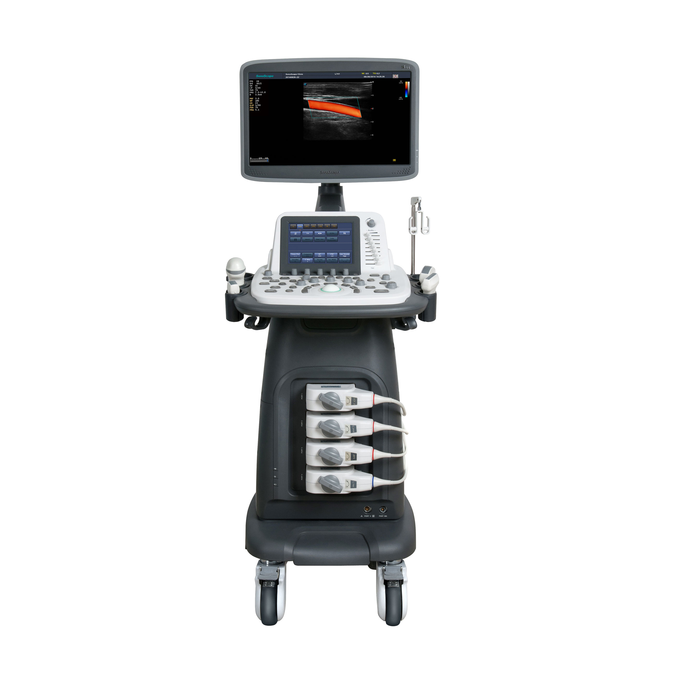 SonoScape S22 Cheap Price Fully Featured Phased Array Trolley Ultrasound Machine With M/TDI/IMT Function