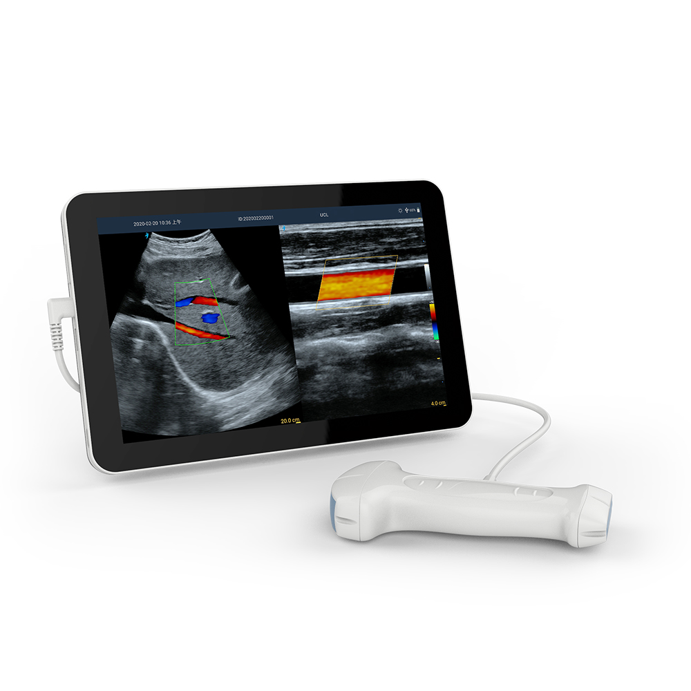 Amain MagiQ MCUCL  Wholesale Price 2 in 1 convex and linear Portable Medical Ultrasound Instrument with High Resolution Imaging