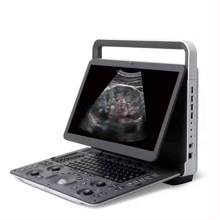 Sonoscape veterinary ultrasound machine e1v for vet color doppler animal portable ultrasound machine