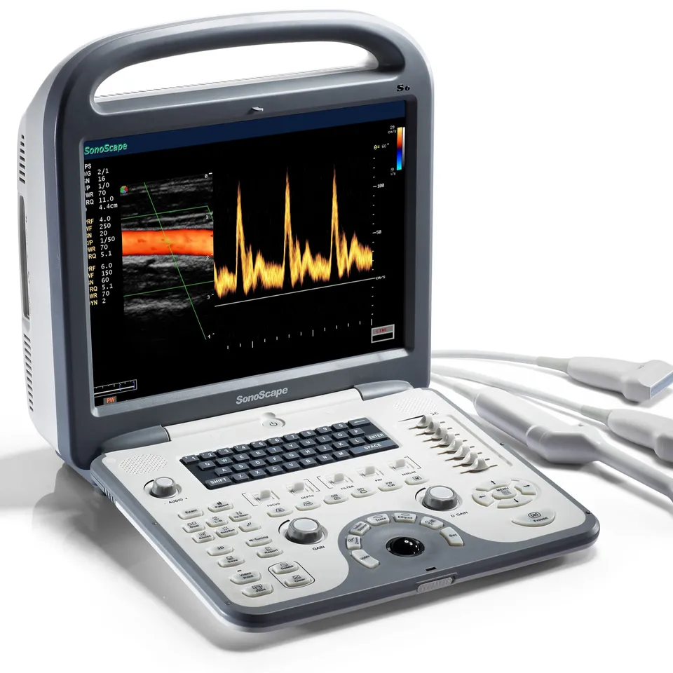 SonoScape S6 Portable 4D Color Doppler Ultrasound Laptop Ultrasound Machine With Advanced Technologies For Human use