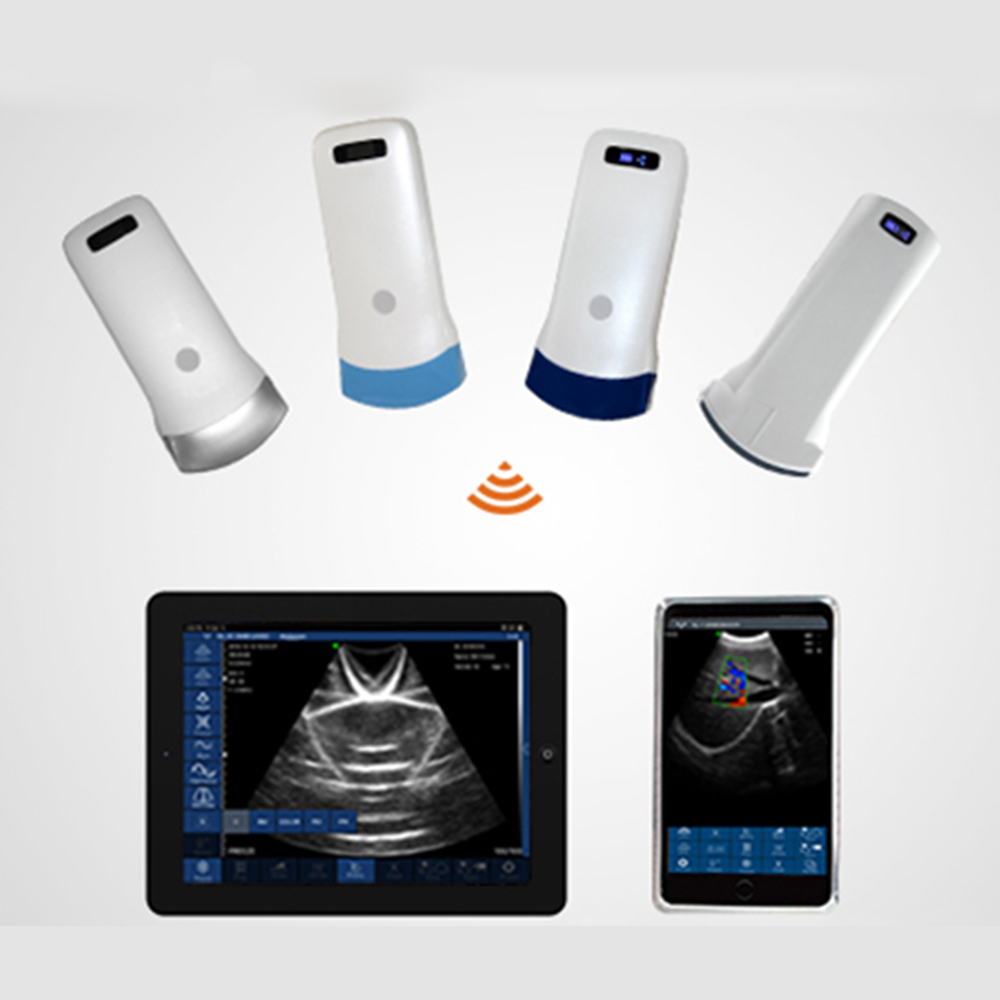 Amain MagiQ CW3 Wholesale Price Basic Wireless Convex black and white Pocket Ultrasound With Wifi Connection