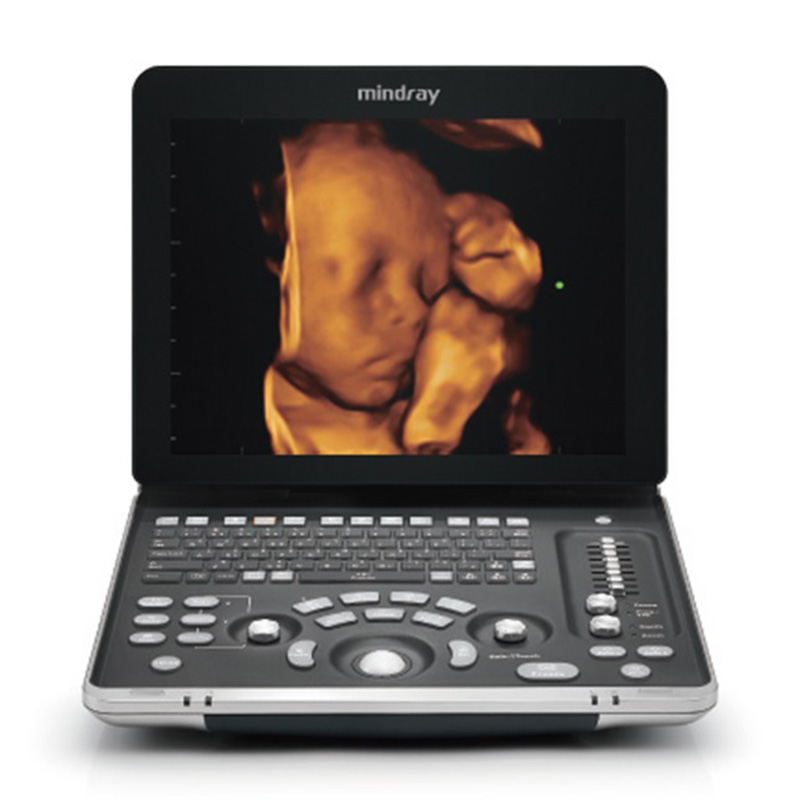 Mindray Z60 Real-time Scanning Ultrasound Device with Optional Transducers for Various Applications