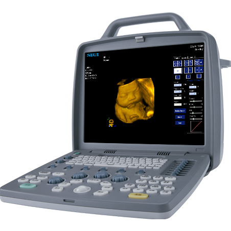 SIUI CTS-8800 Plus Upgraded medical ultrasound instruments BW  4D imaging B/W laptop ultrasound system with 15-inch medical LCD