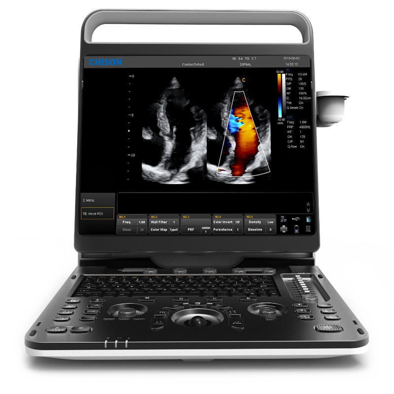 Chison EBIT 60/60v 4D/5D fetal real-time imaging and Cardiac diagnosis ultrasound system with Versatile Measurement Package