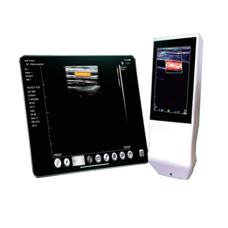 Amain OEM/ODM Manufacture Wireless Medical Ultrasound Instruments with Touch Screen