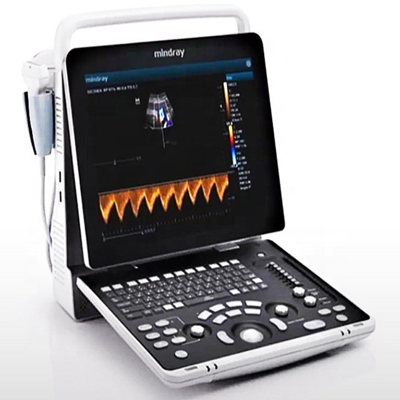 Mindray Z50 Large Display Convenient Hand-carried Color Doppler Ultrasound Equipment with Adjustable Monitor