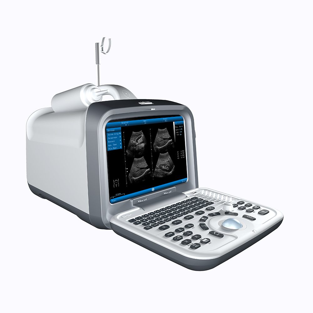 ZONCARE ZQ-6022 Medical Ultrasound Instruments Portable Ultrasound Machine Scanning System for Hospital Use