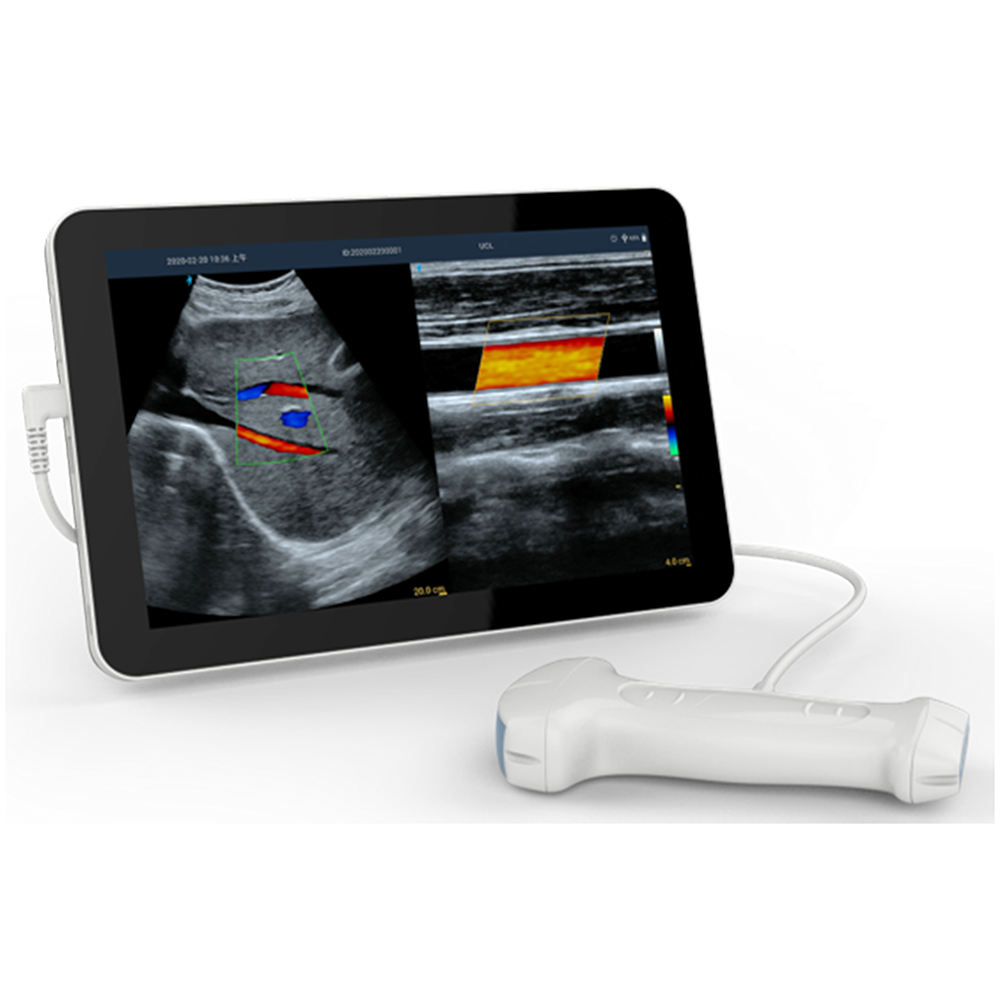 Pregnancy Scan equipment Ultrasound  Amain MagiQ MCUCL  with Dual Probe for Android Ultrasound Scanner