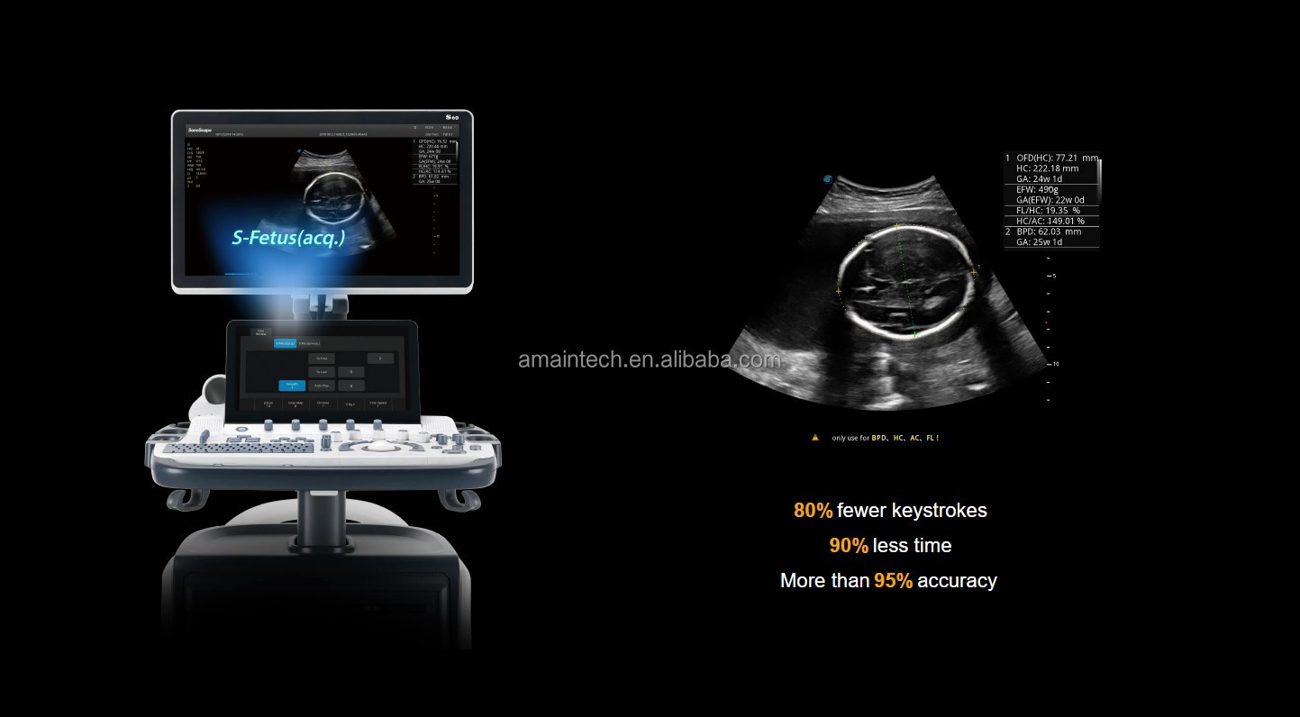 Sonoscape Enhanced Version Piattaforma Wis+ intelligente Sonoscape S60 4D Trolley sistema a ultrasuoni per diagnosi Con sonde multiple