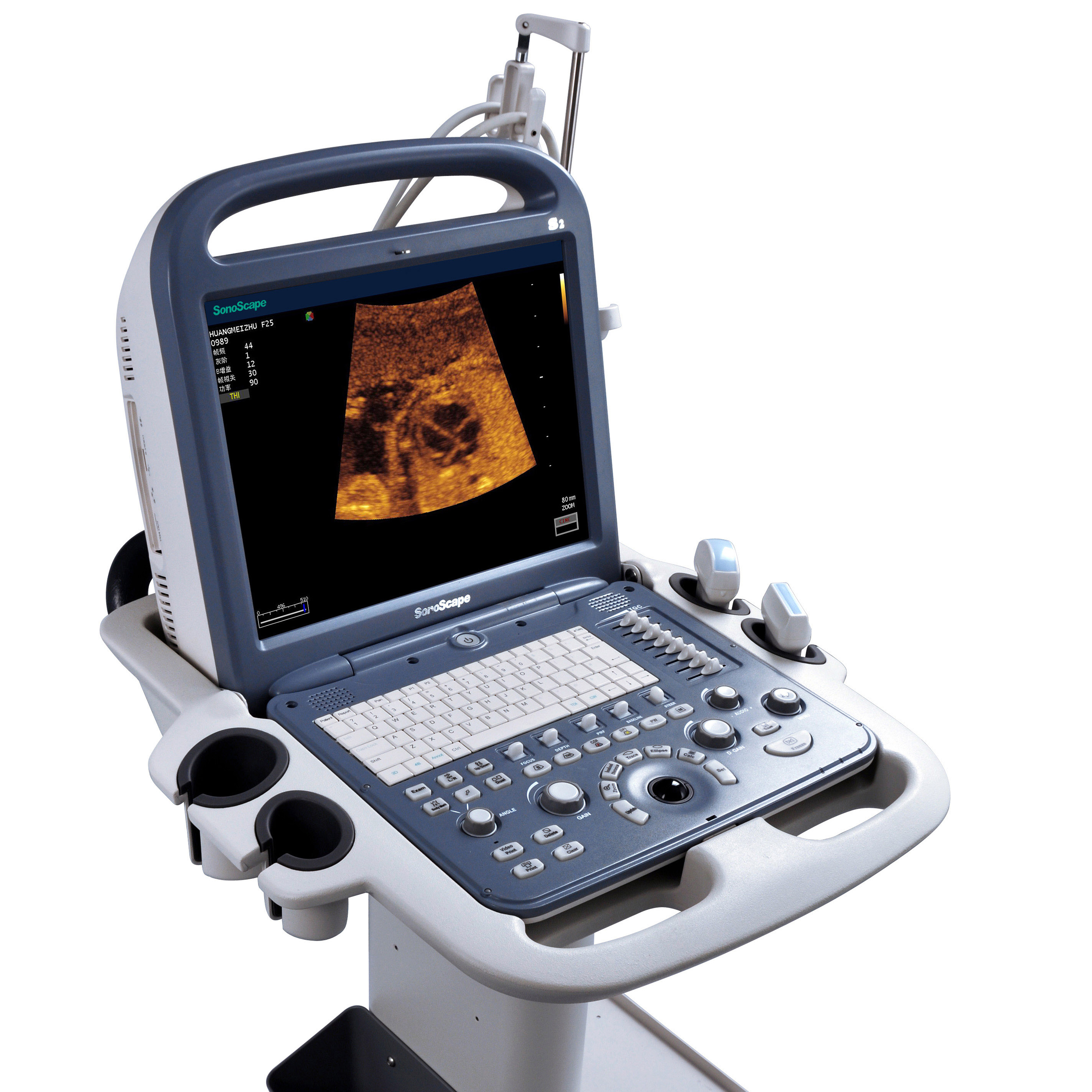 SonoScape S2 New Generation Notebook Ultrasound Machine With Intelligent Imaging System For Gynecology and Urology Use