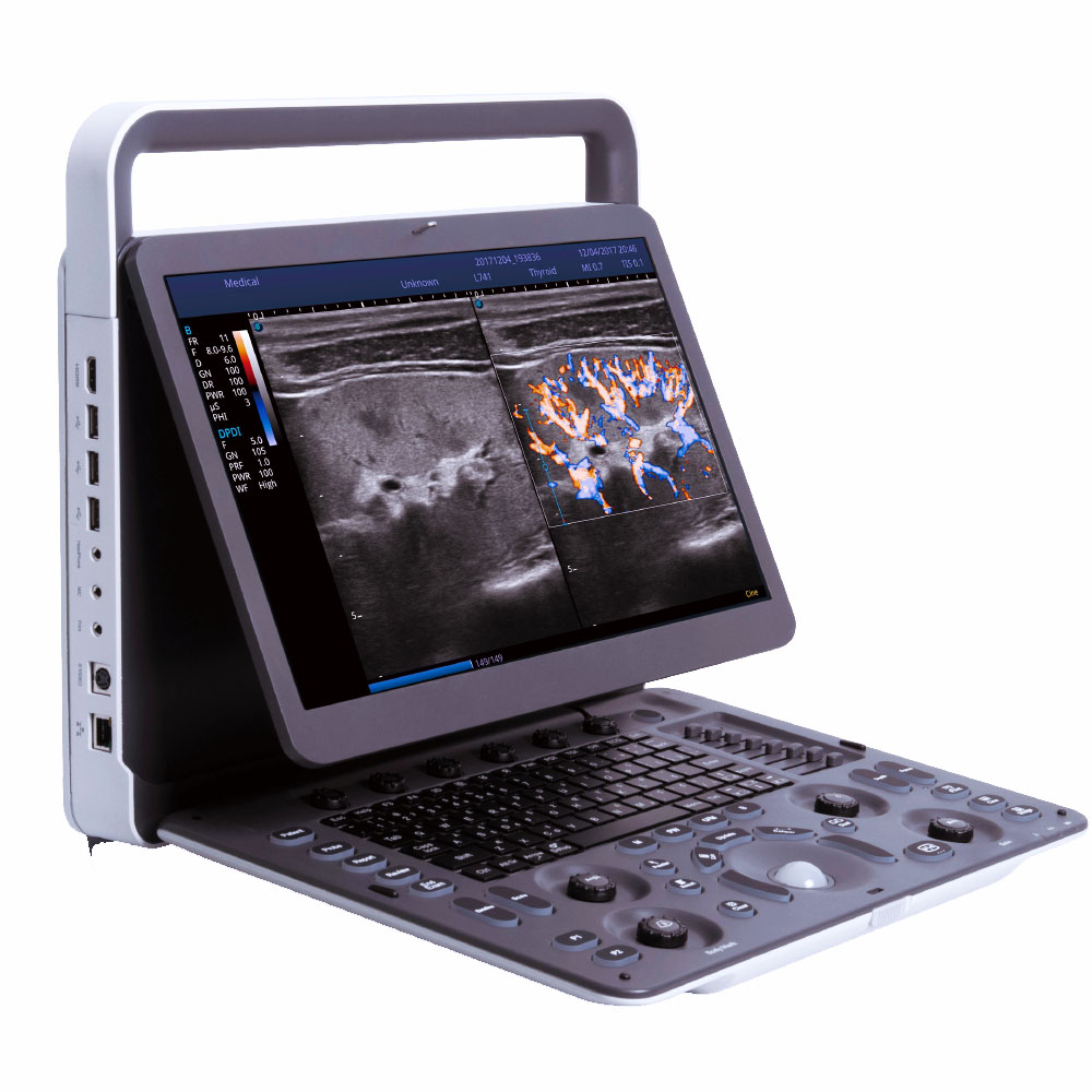 Sonoscape E2 Mobile Ultrasound for medical supplies
