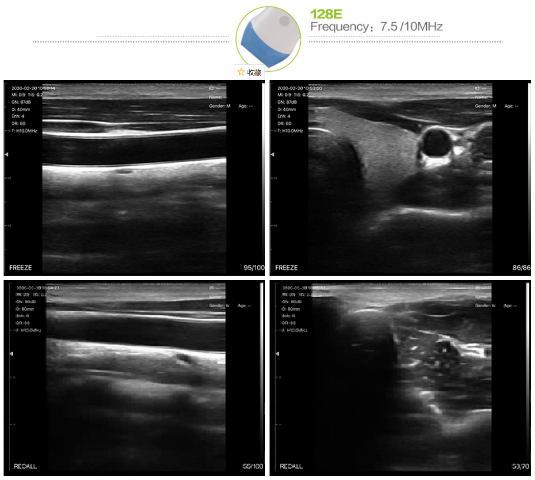 Amain OEM/ODM 128 o elfennau 10-14MHZ LW5N Delweddu Harddwch meddygol uwchsain du a gwyn Sganiwr Diwydiant Esthetig